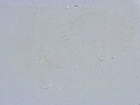 Thulinius saltursus image