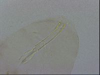 Thulinius saltursus image