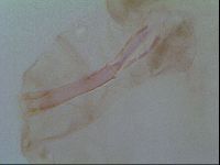 Thulinius saltursus image