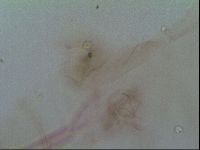 Thulinius saltursus image