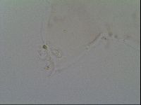 Thulinius saltursus image