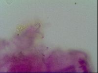 Thulinius saltursus image