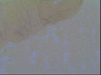 Thulinius saltursus image