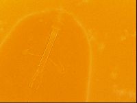 Thulinius saltursus image