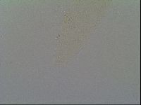 Media resource of Itaquascon placophorum