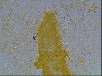Astatumen bartosi image