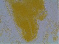 Astatumen bartosi image