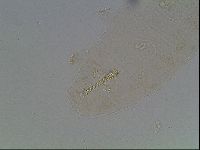Macrobiotus anderssoni image