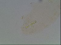 Macrobiotus anderssoni image