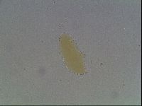 Macrobiotus anderssoni image