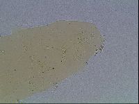 Macrobiotus anderssoni image