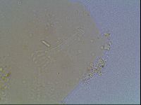 Macrobiotus anderssoni image