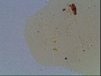 Macrobiotus anderssoni image