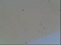 Macrobiotus anderssoni image