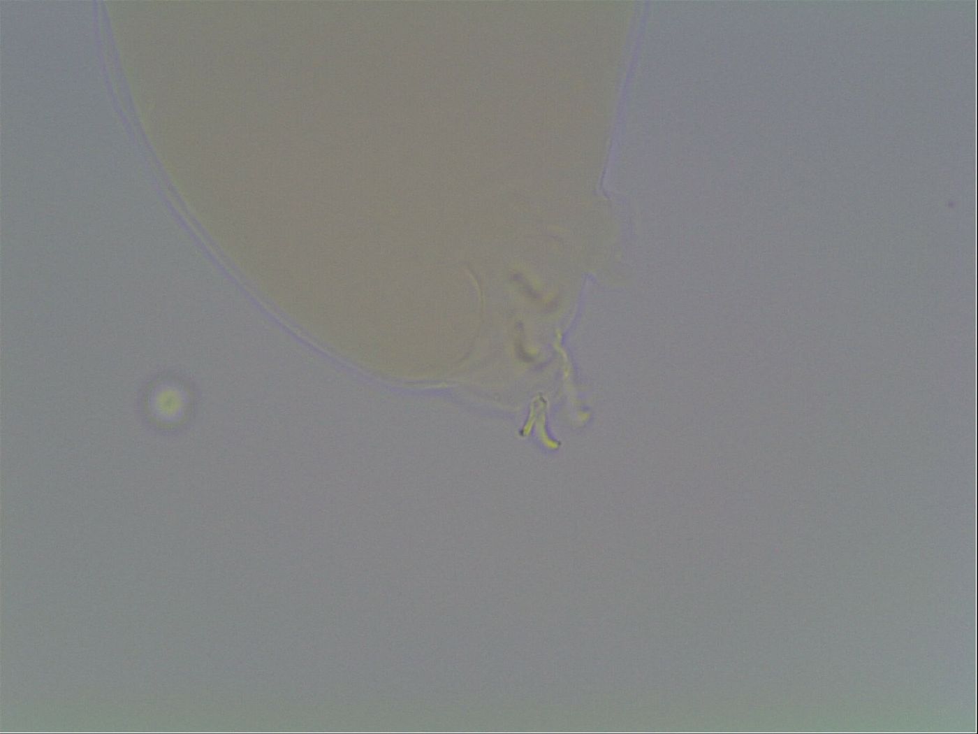 Macrobiotus anderssoni image