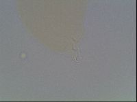 Macrobiotus anderssoni image