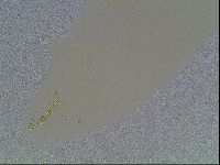 Macrobiotus anderssoni image