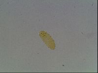 Macrobiotus anderssoni image