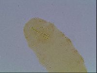 Macrobiotus anderssoni image