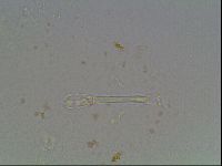 Macrobiotus anderssoni image