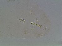 Media resource of Macrobiotus anderssoni