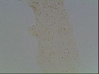 Macrobiotus anderssoni image