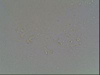 Macrobiotus anderssoni image