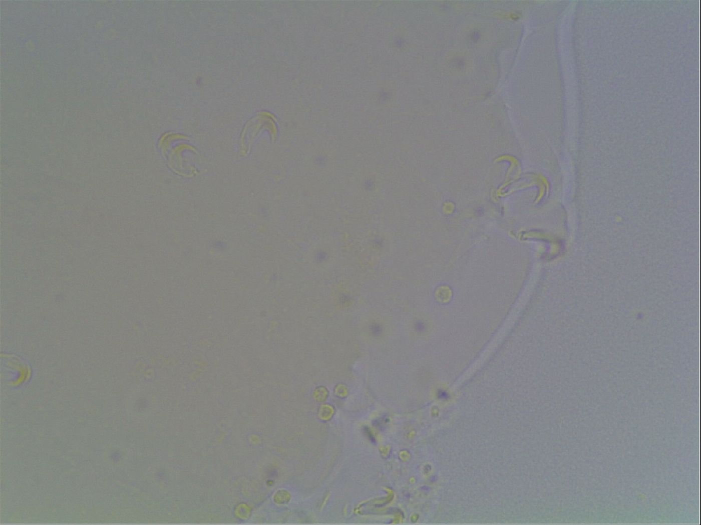 Macrobiotus anderssoni image