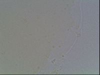 Macrobiotus anderssoni image