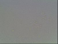 Macrobiotus anderssoni image