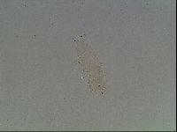 Macrobiotus anderssoni image