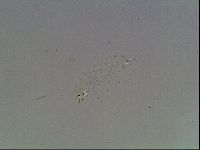 Macrobiotus anderssoni image