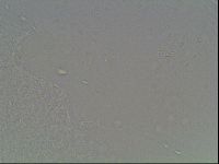 Macrobiotus anderssoni image
