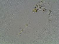 Macrobiotus anderssoni image
