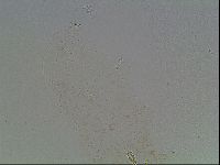 Macrobiotus anderssoni image