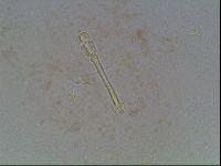Macrobiotus anderssoni image