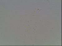 Macrobiotus anderssoni image