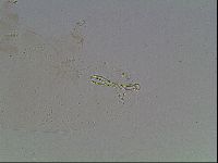 Macrobiotus anderssoni image