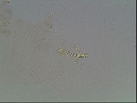 Macrobiotus anderssoni image