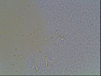 Macrobiotus anderssoni image
