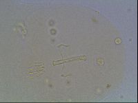 Macrobiotus anderssoni image
