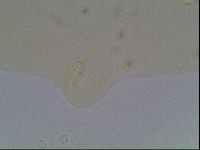 Macrobiotus anderssoni image
