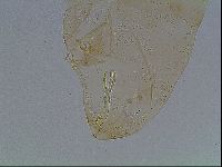 Macrobiotus anderssoni image