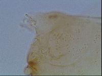 Macrobiotus anderssoni image