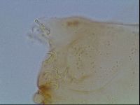 Macrobiotus anderssoni image