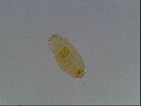 Macrobiotus anderssoni image
