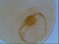 Macrobiotus anderssoni image