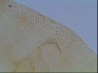 Macrobiotus anderssoni image