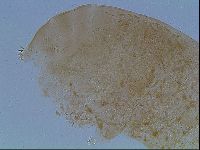 Macrobiotus anderssoni image