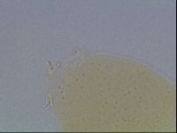 Macrobiotus anderssoni image